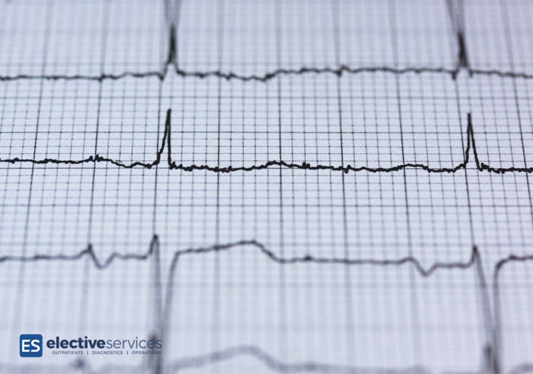 What is an Echocardiogram?